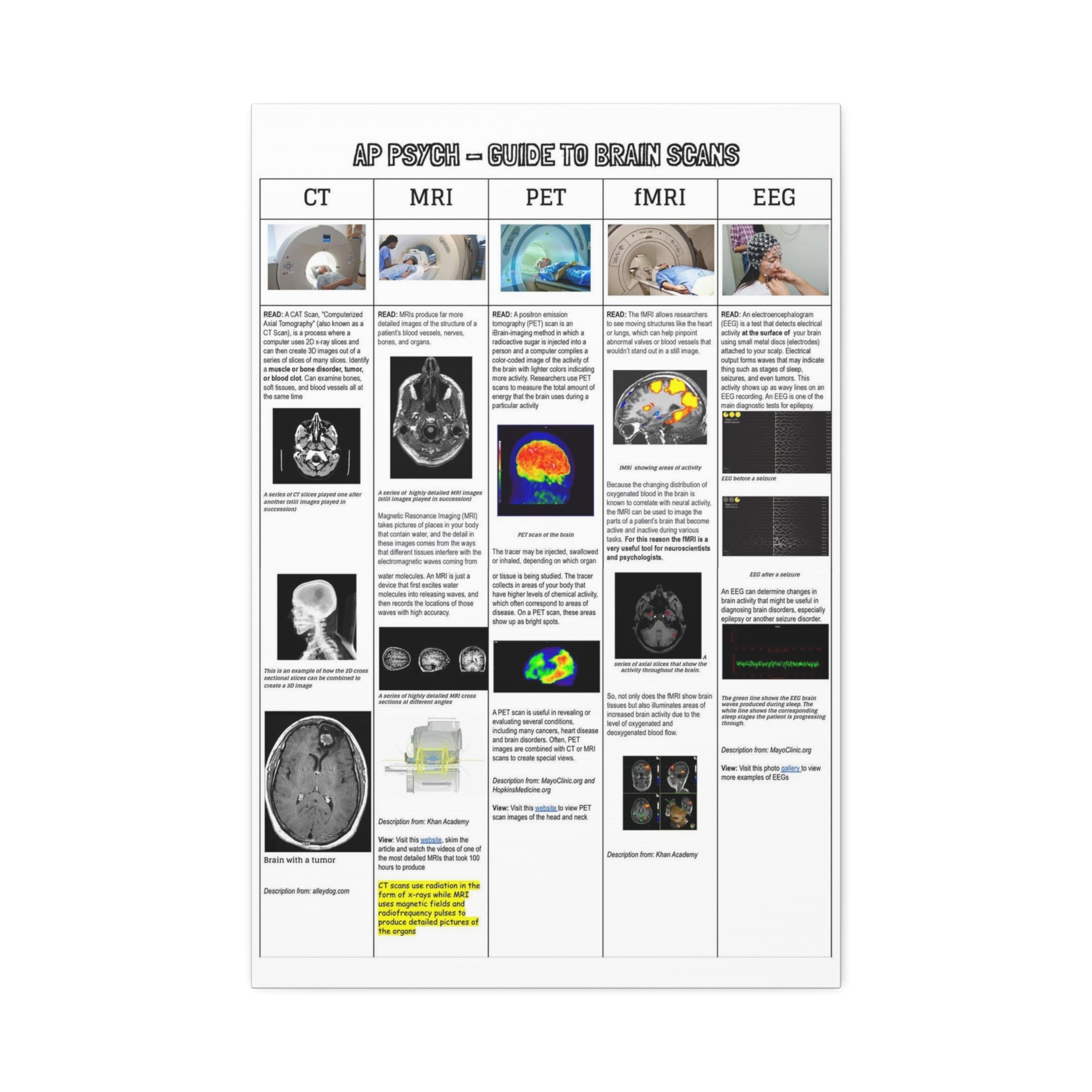 AP Psychology Brain Scans Poster, CT MRI PET fMRI EEG Comparison Chart, Medical Imaging Educational Canvas Print