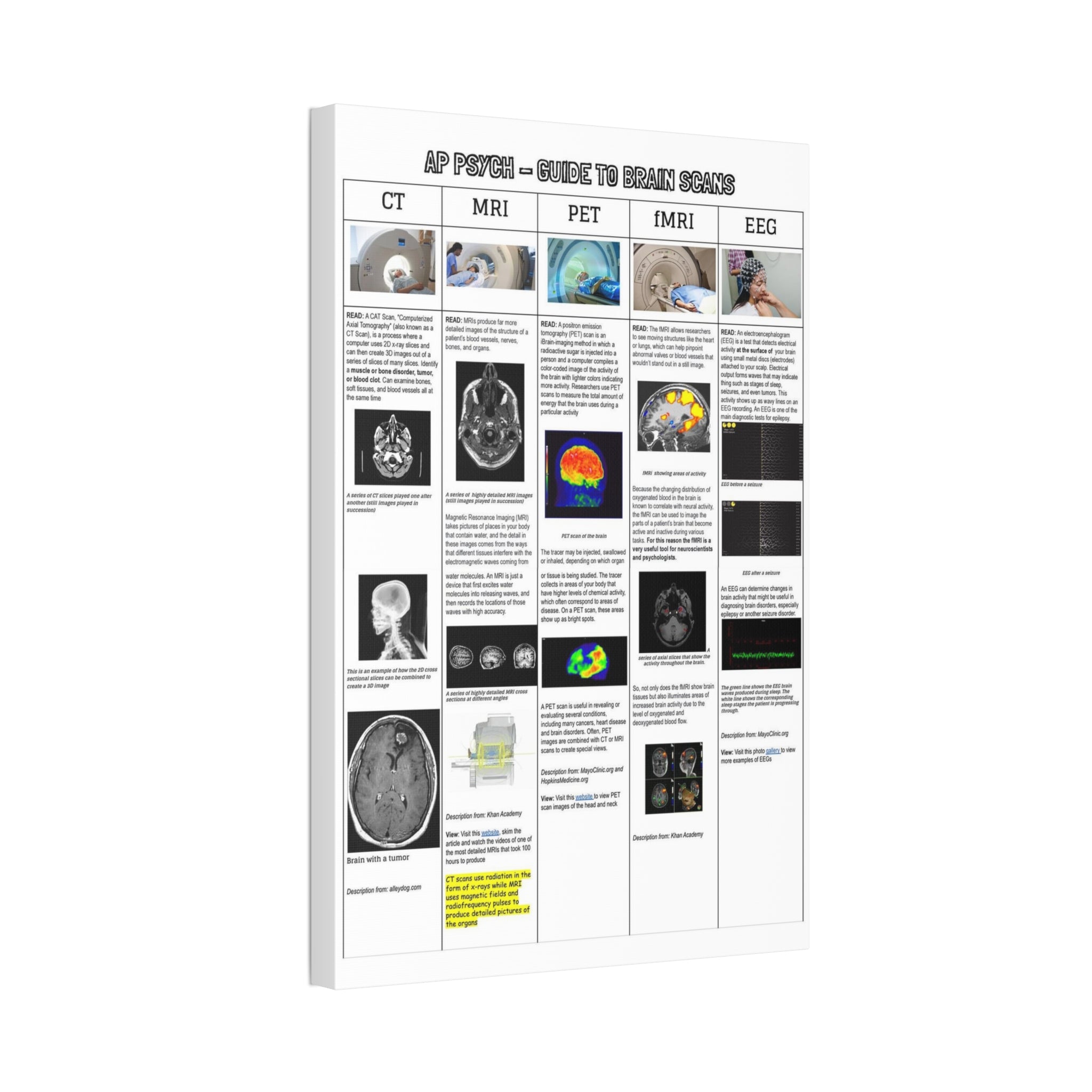 AP Psychology Brain Scans Poster, CT MRI PET fMRI EEG Comparison Chart, Medical Imaging Educational Canvas Print