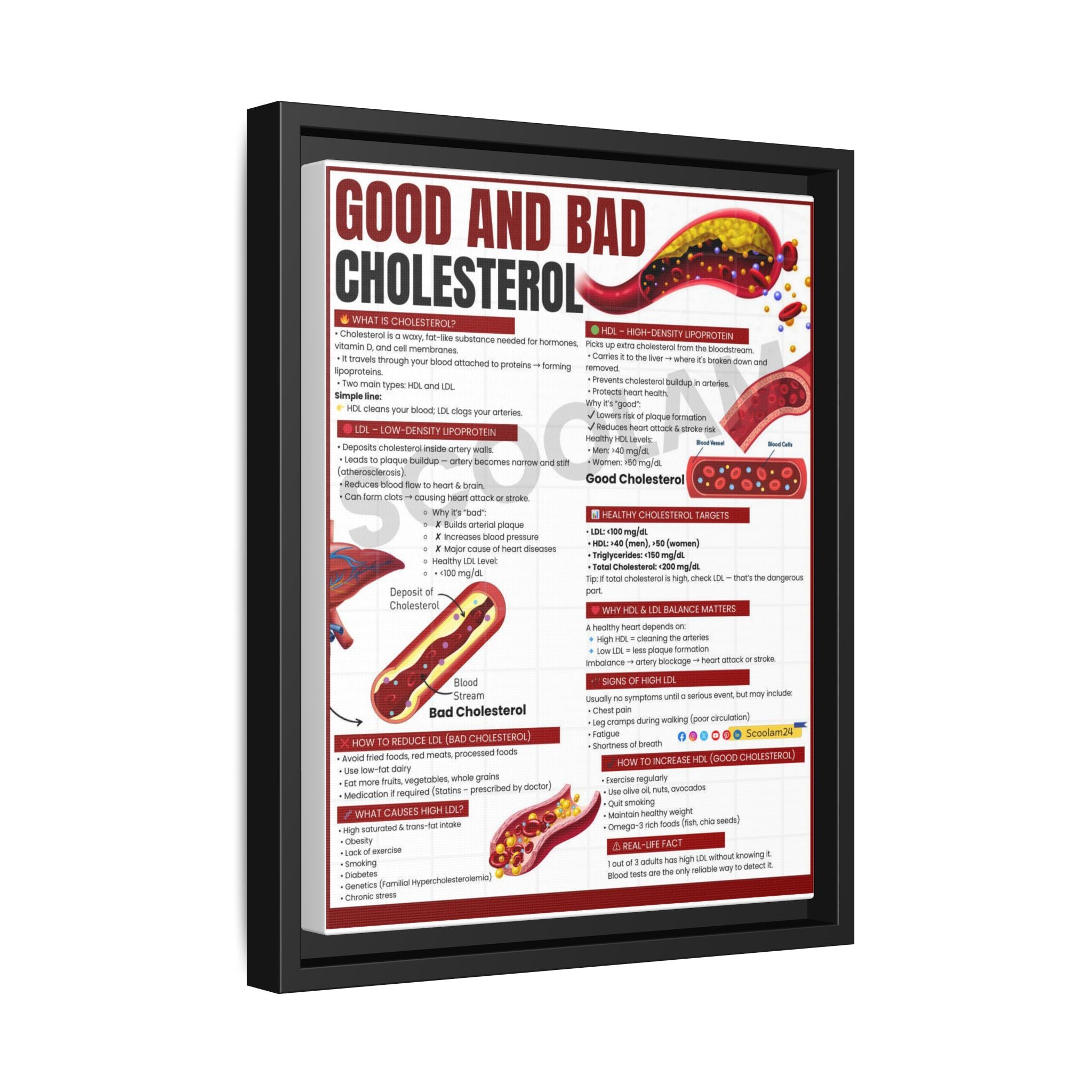 Good and Bad Cholesterol Poster, HDL vs LDL Comparison Chart, Healthy Cholesterol Levels Guide, Heart Health Educational Canvas Print