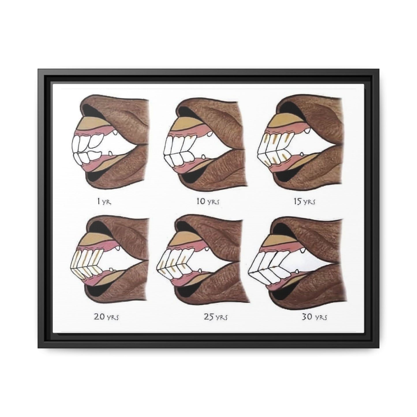 How To Tell A Horse’s Age Poster, Horse Teeth Aging Guide Horizontal Poster