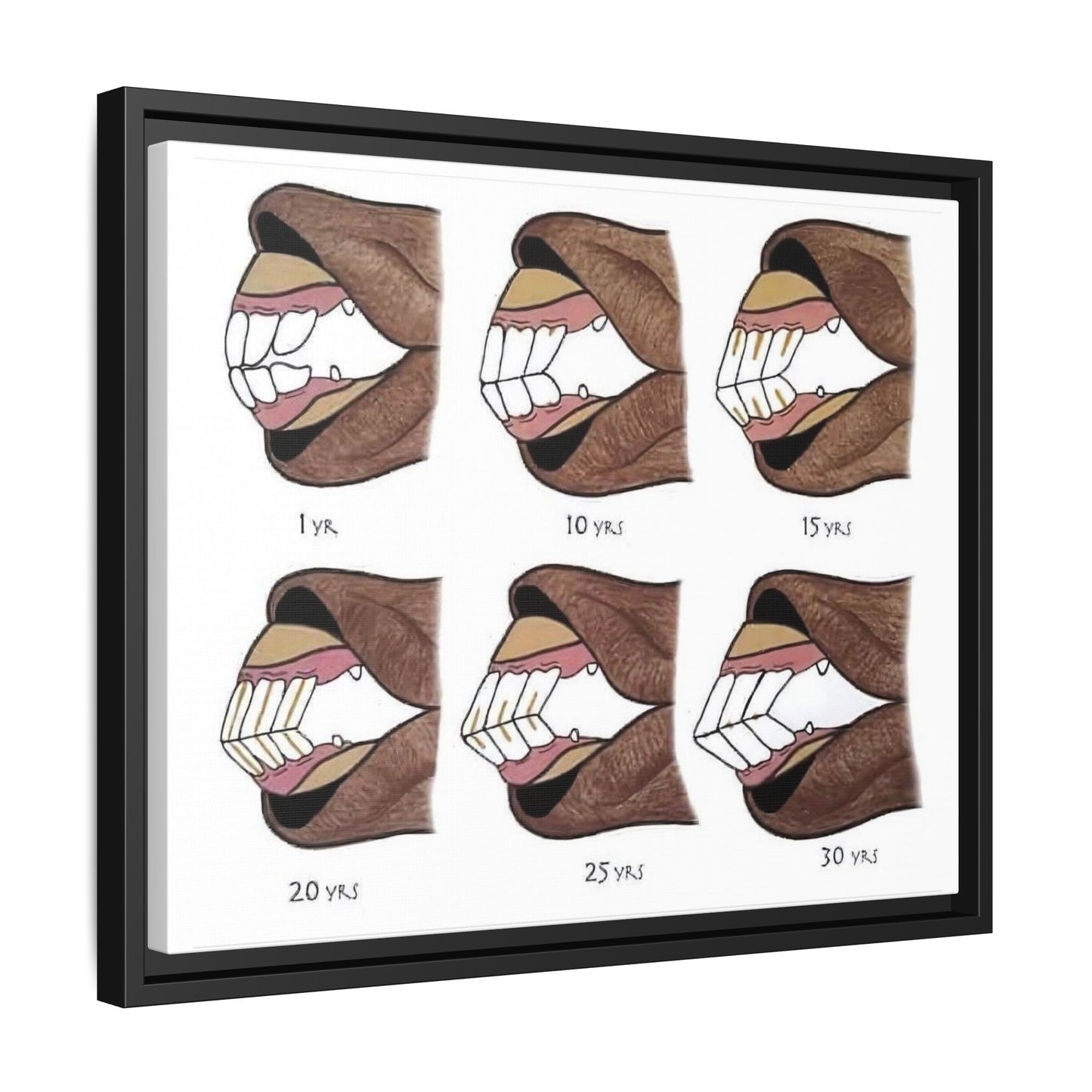 How To Tell A Horse’s Age Poster, Horse Teeth Aging Guide Horizontal Poster