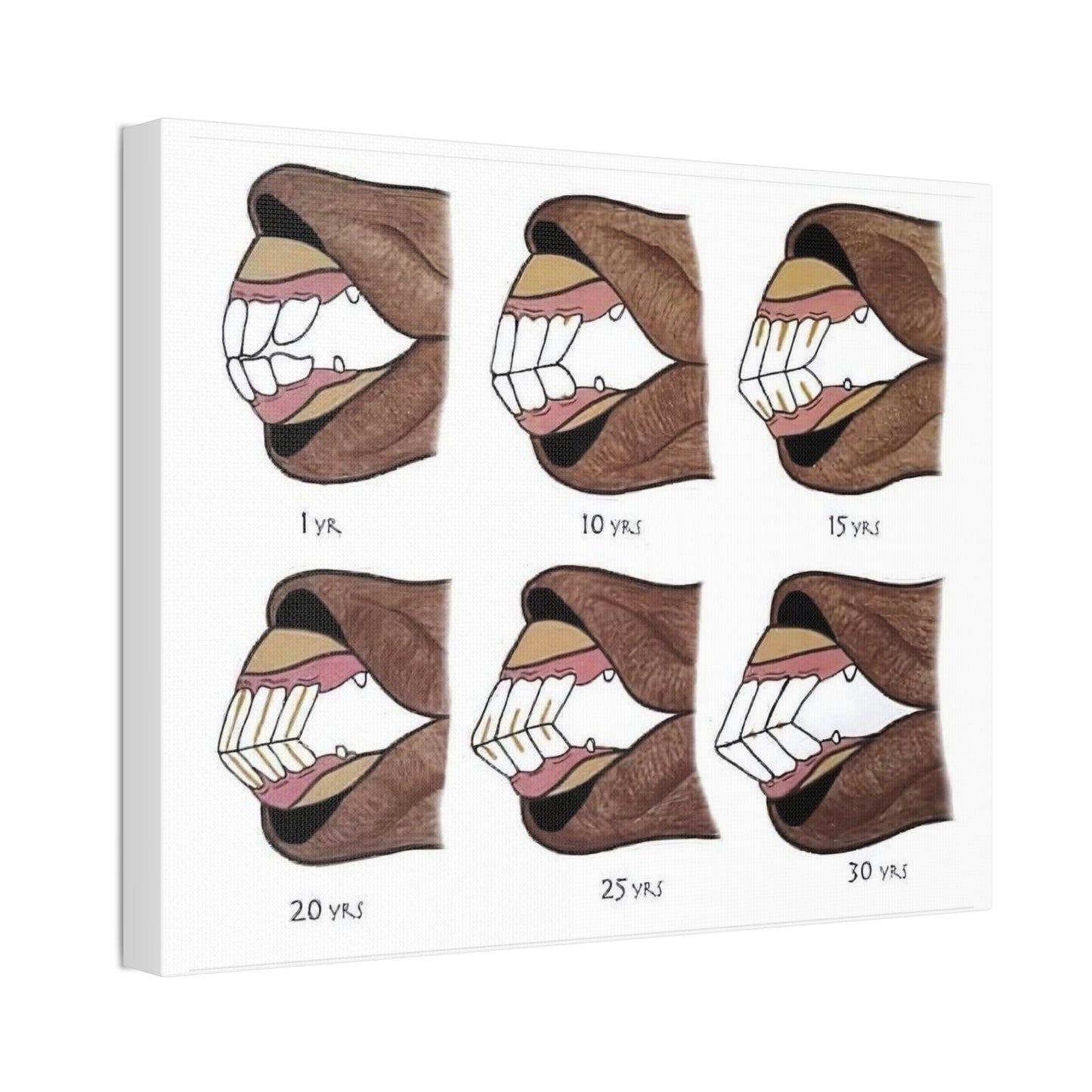 How To Tell A Horse’s Age Poster, Horse Teeth Aging Guide Horizontal Poster